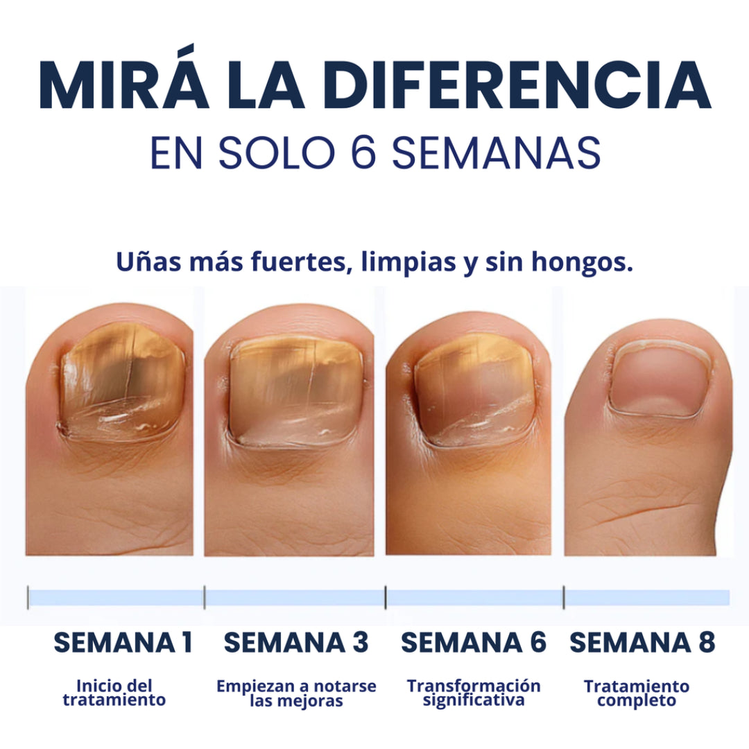 Parches Antihongos - Eliminan Hongos y Regeneran tus Uñas