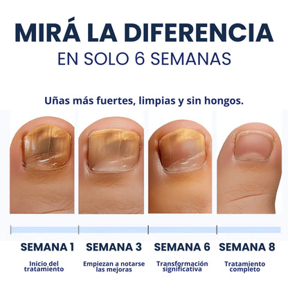 Parches Antihongos - Eliminan Hongos y Regeneran tus Uñas