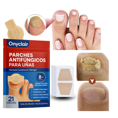 Parches Antihongos - Eliminan Hongos y Regeneran tus Uñas